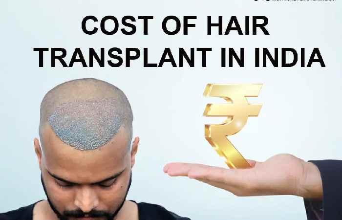 Cost of Hair Transplant in India (1)