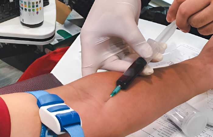 MPV Blood Test (1)