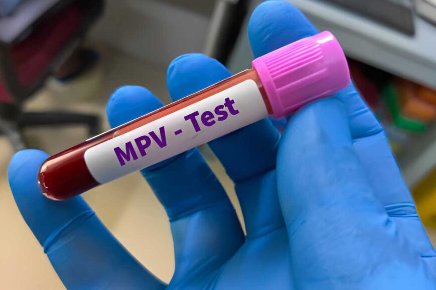 MPV Blood Test