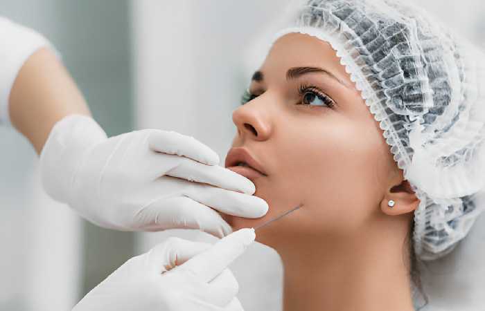 Thread Lift - the procedure