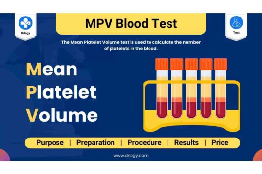 Mpv in Blood Test